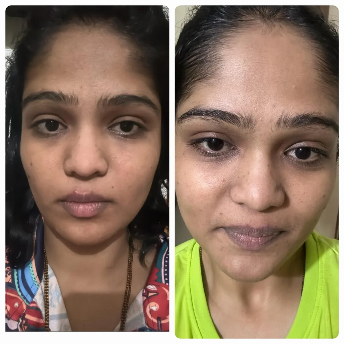 A student before and after a Face Yoga program