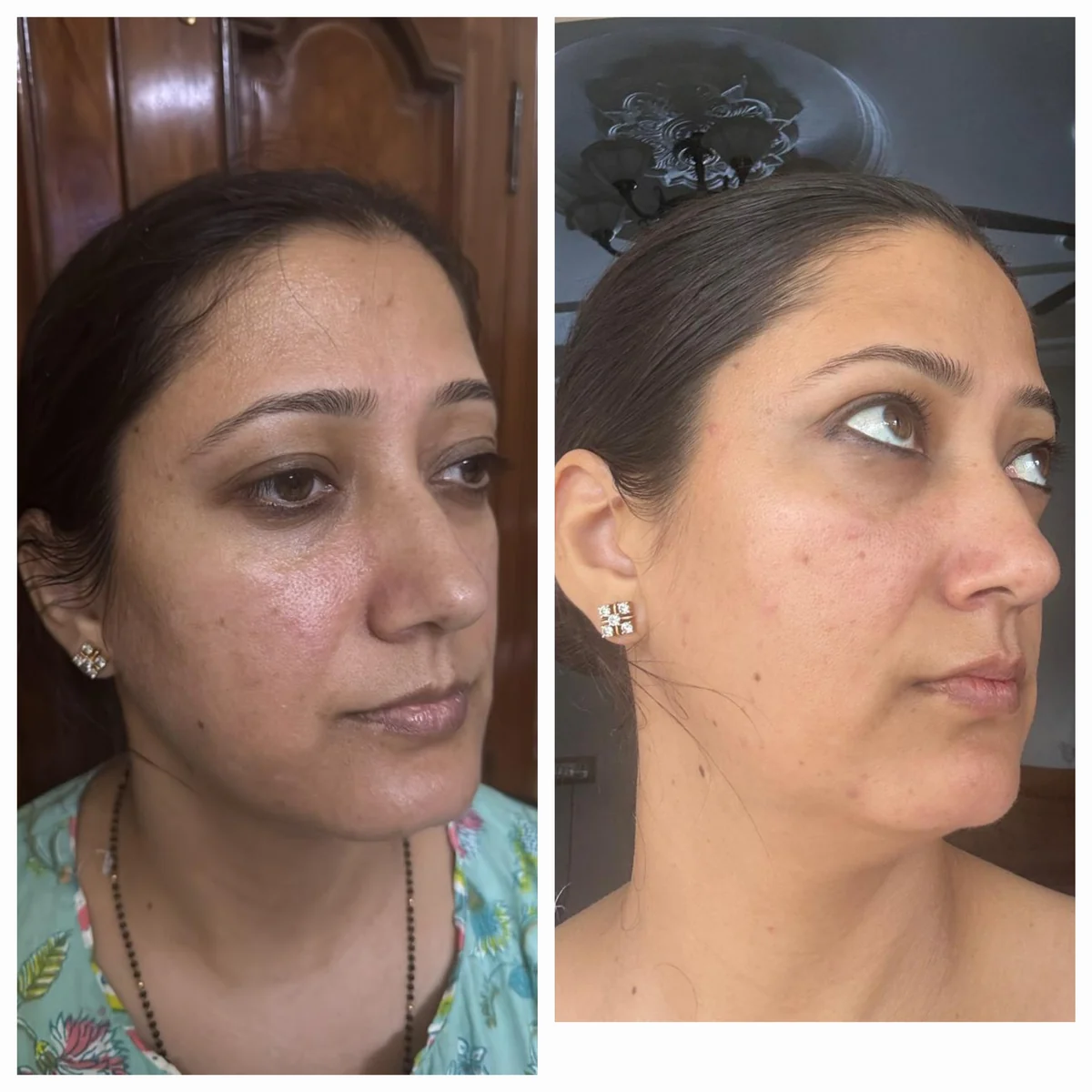 The same student, front and profile views, before and after practice